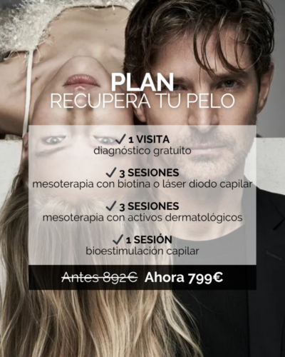 plan recupera tu pelo
